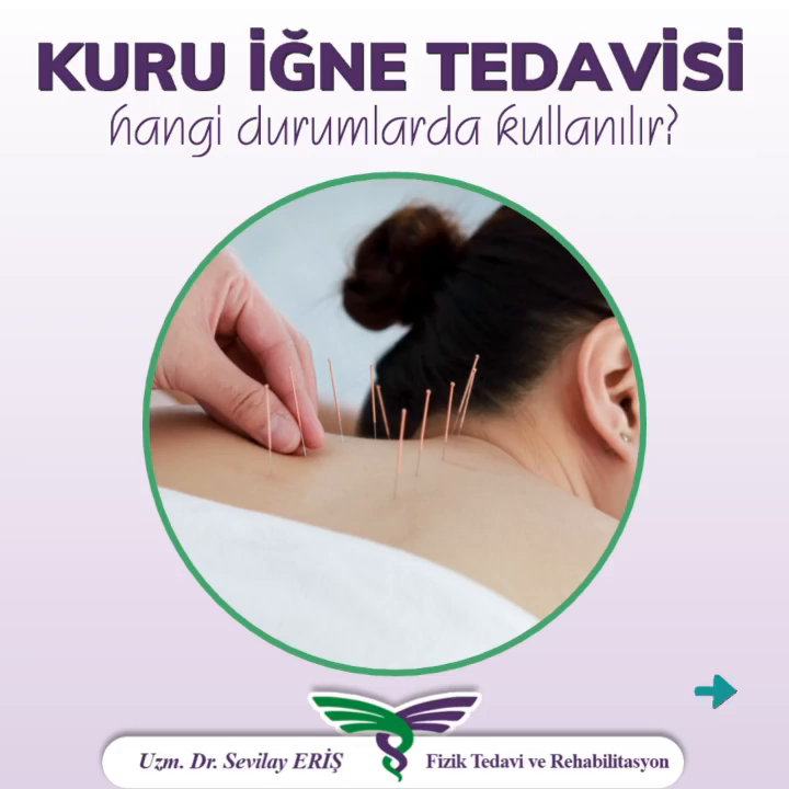 Carousel post from uzm.drsevilayeris.klinik.