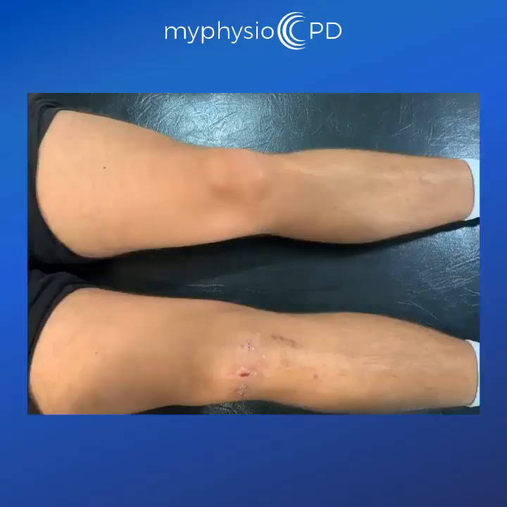 Video post from myphysiocpd.