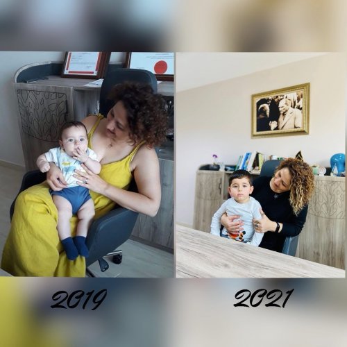 Photo post from uzm.drsevilayeris.klinik.