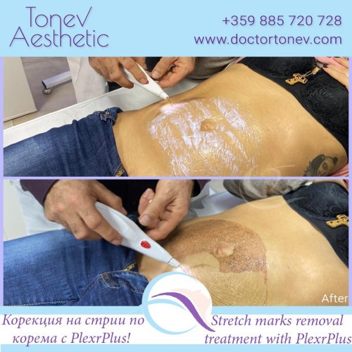 Photo post from dr.tonev.