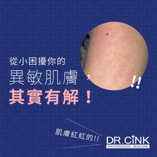 Photo post from drcink.