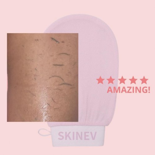 Photo post from skinevcare.