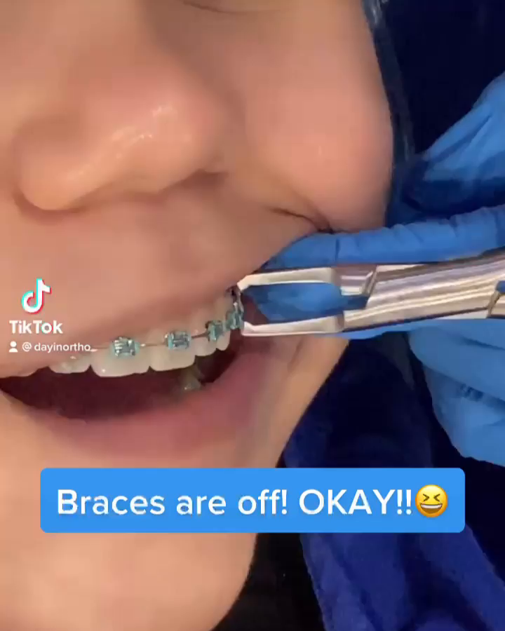 Video post from rio_dental.