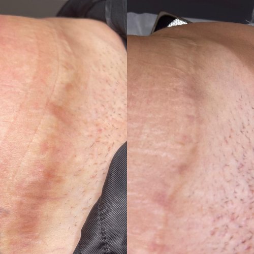 Photo post from richbichclinic.