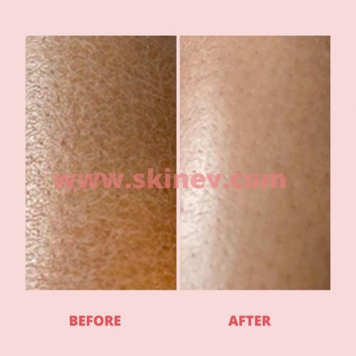 Photo post from skinevcare.