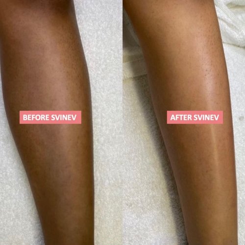 Carousel post from skinevcare.