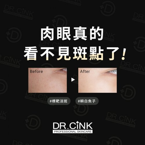 Photo post from drcink.