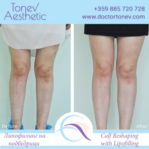 Carousel post from dr.tonev.