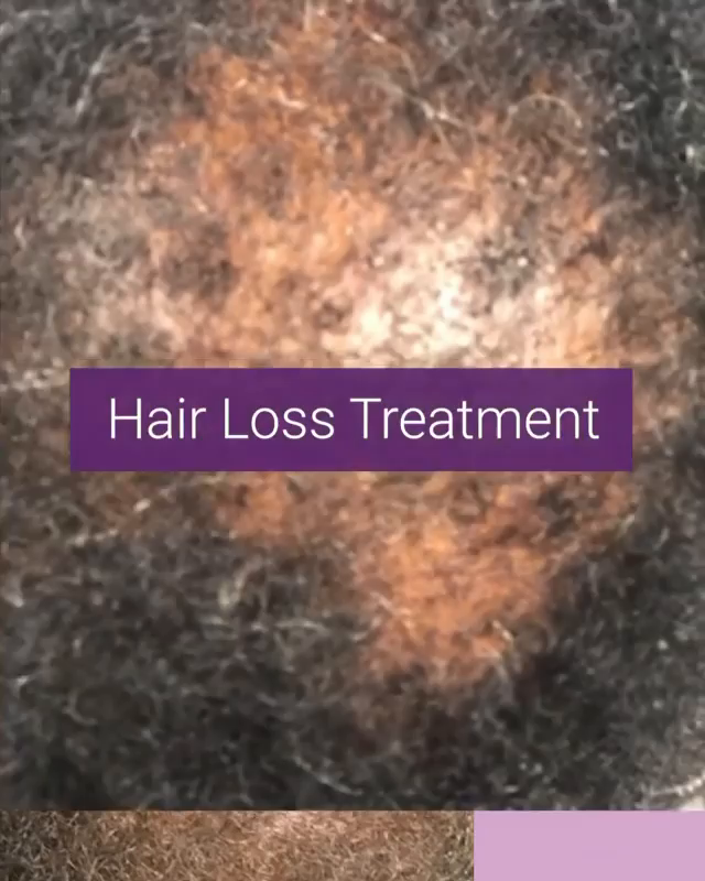 Video post from kerafactor.