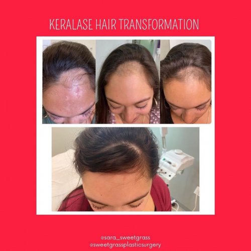 Photo post from kerafactor.
