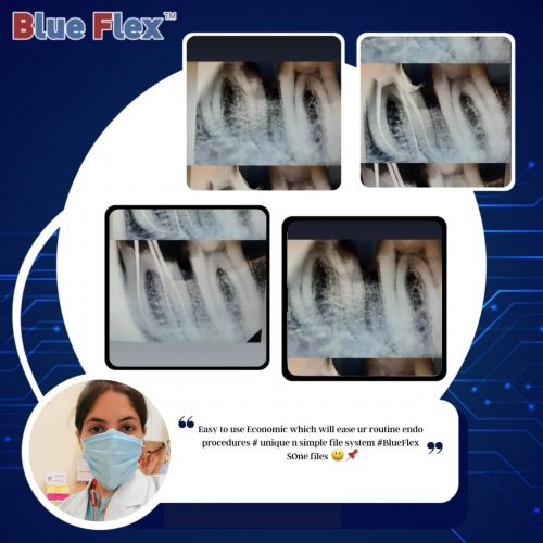 Photo post from blueflex_endo.