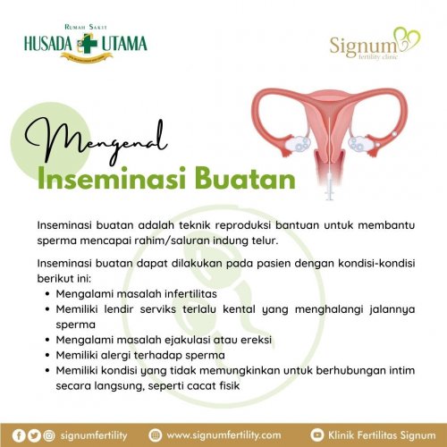PostPhoto