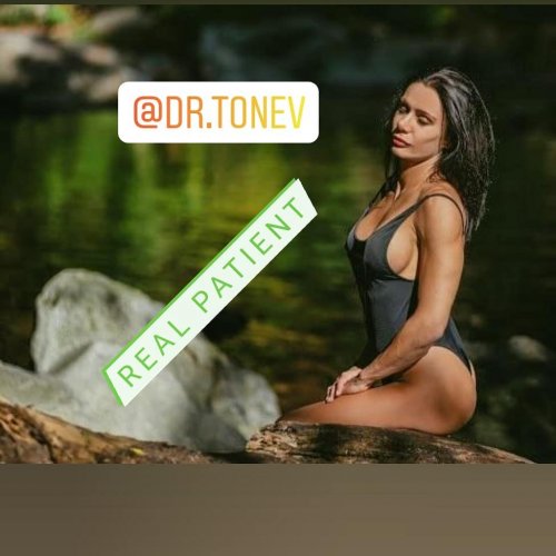 Photo post from dr.tonev.