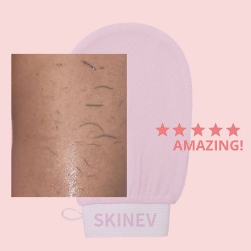 Photo post from skinevcare.