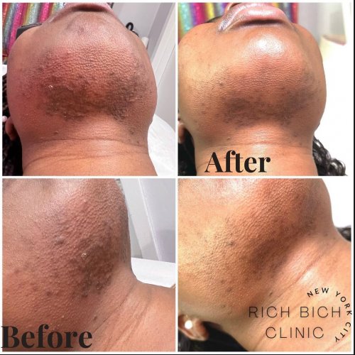 Photo post from richbichclinic.