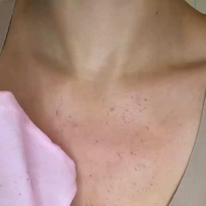 Video post from skinevcare.