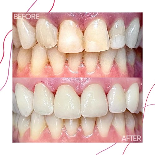 Photo post from trilliumdental.