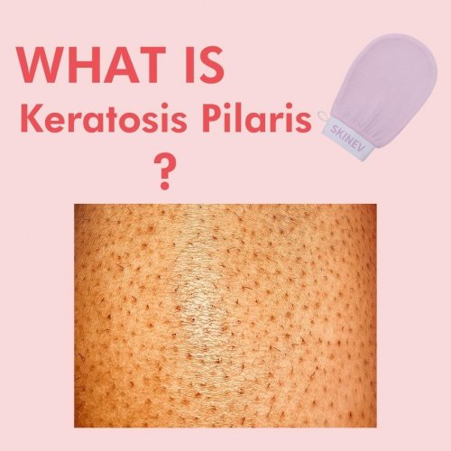 Photo post from skinevcare.