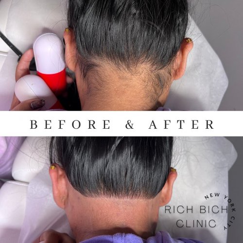 Photo post from richbichclinic.