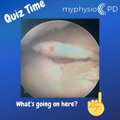Photo post from myphysiocpd.