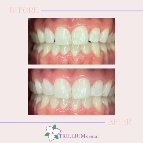 Photo post from trilliumdental.