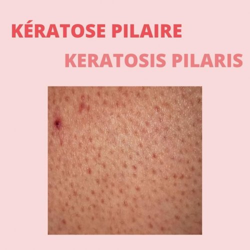 Photo post from skinevcare.