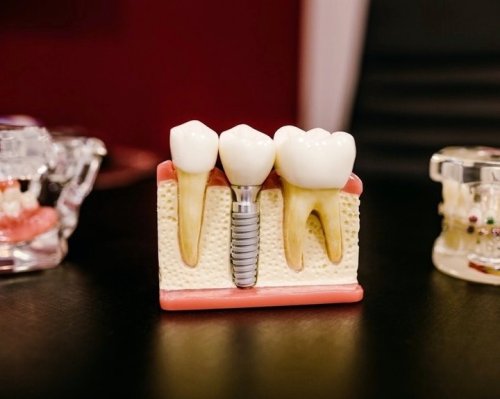 Photo post from trilliumdental.