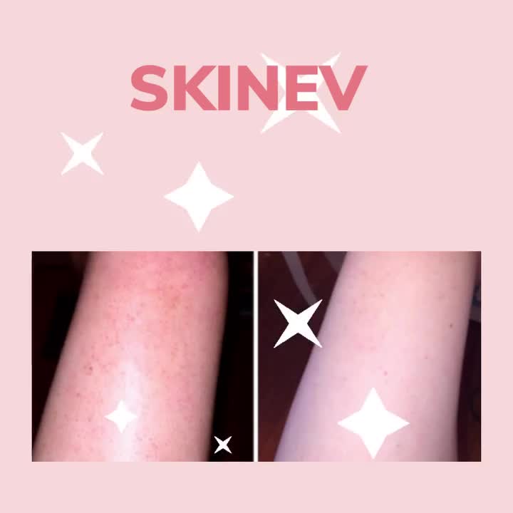 Video post from skinevcare.