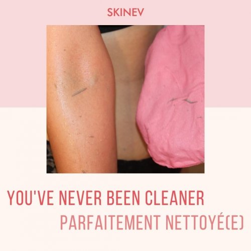 Photo post from skinevcare.