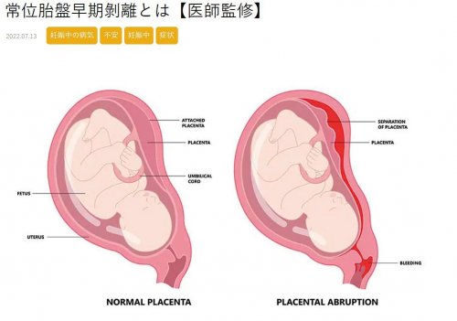 Photo post from hiroclinic_nipt_official.