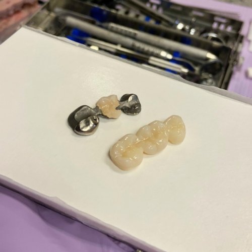 Photo post from trilliumdental.