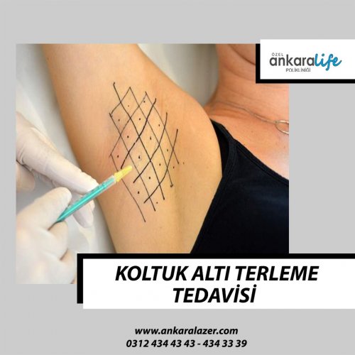 PostPhoto