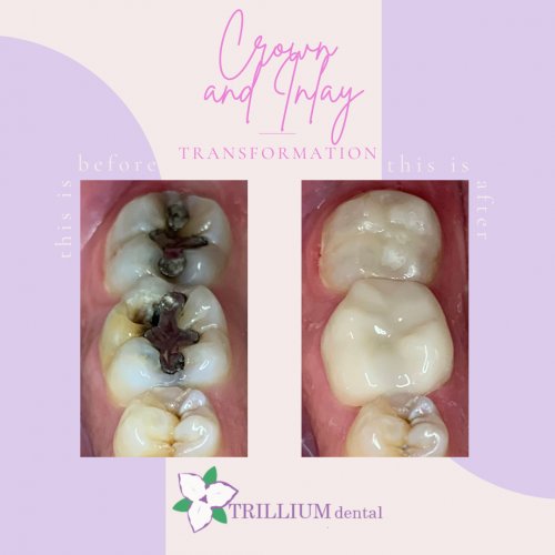 Photo post from trilliumdental.