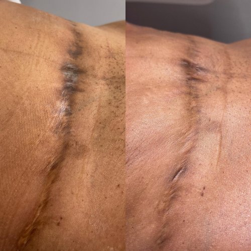 Photo post from richbichclinic.
