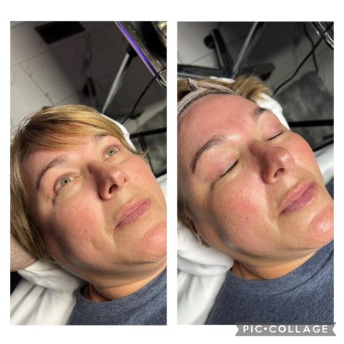 Photo post from lushaestheticsky.