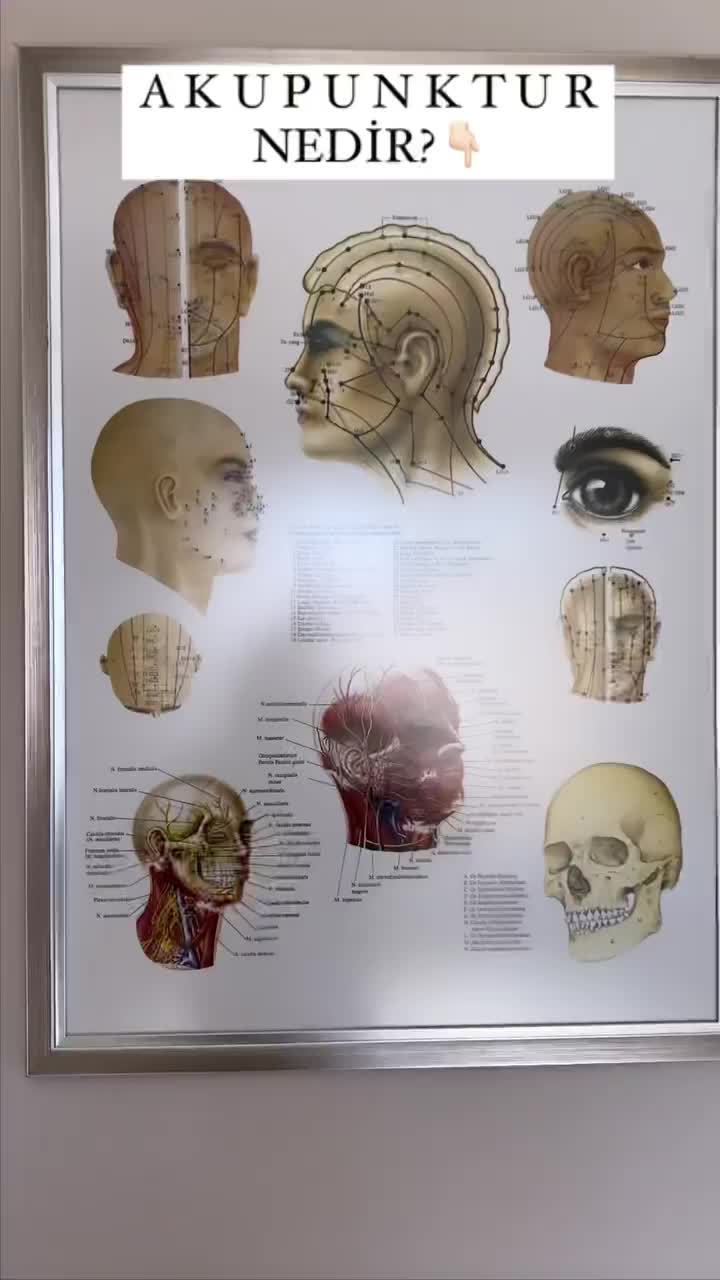Video post from uzm.drsevilayeris.klinik.