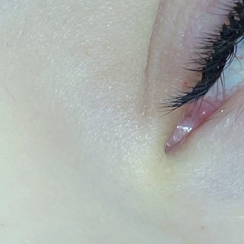 PostPhoto