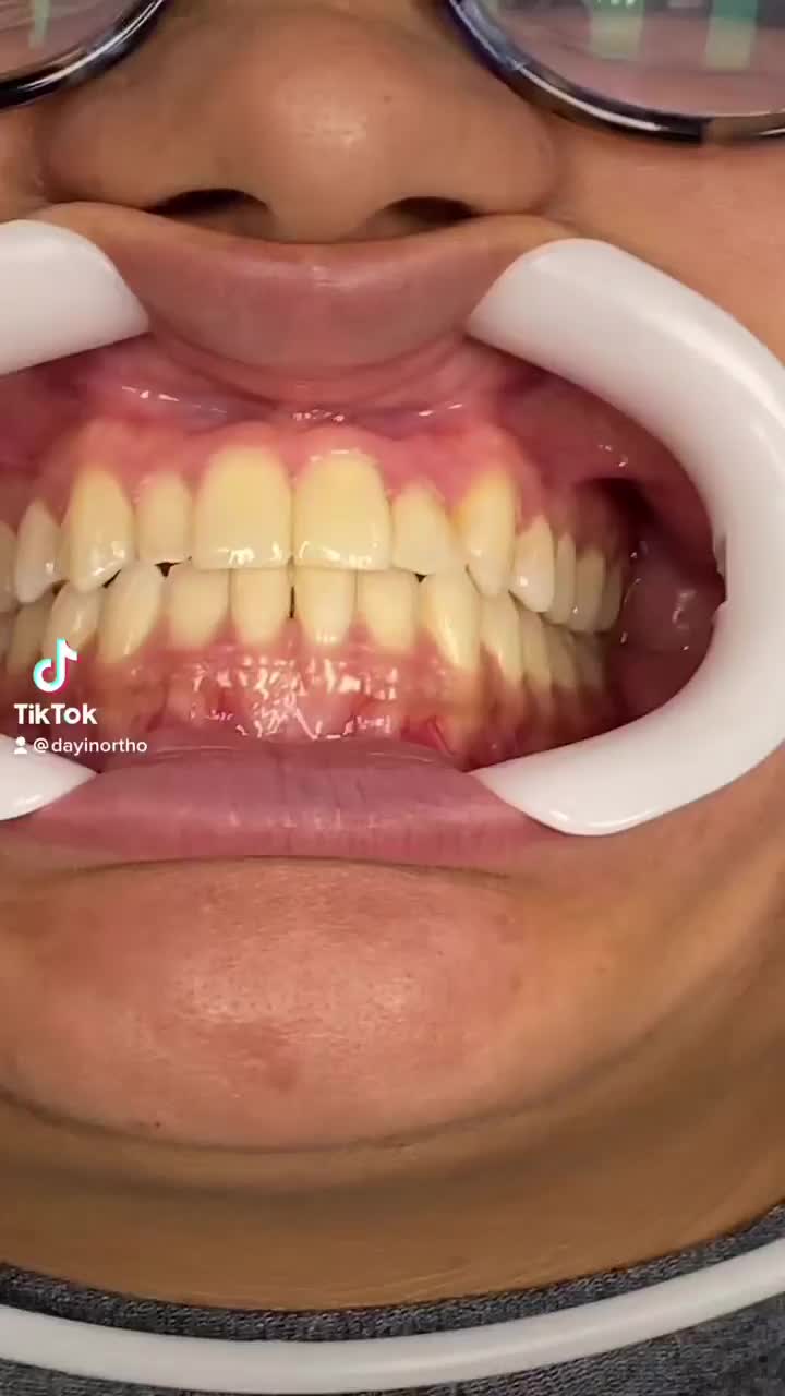 Video post from rio_dental.