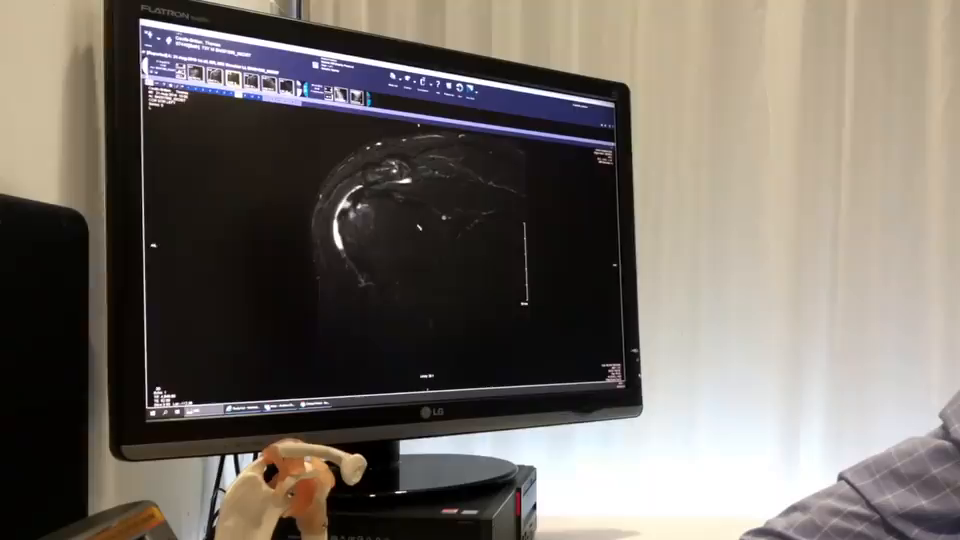 Video post from myphysiocpd.