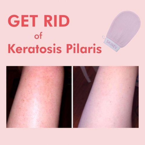 Photo post from skinevcare.