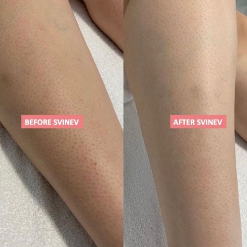 Photo post from skinevcare.