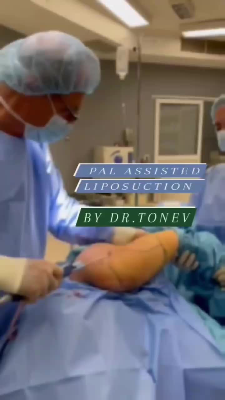 Video post from dr.tonev.