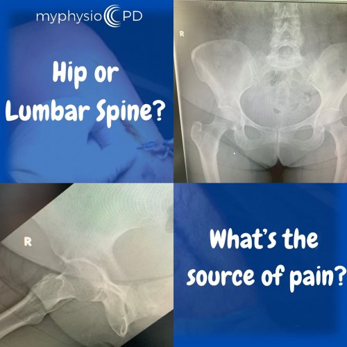 Photo post from myphysiocpd.