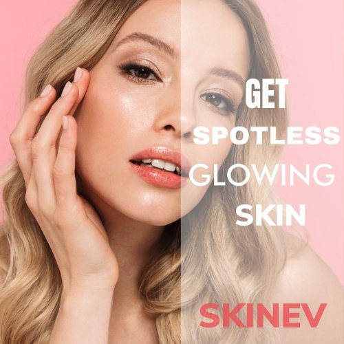 Photo post from skinevcare.