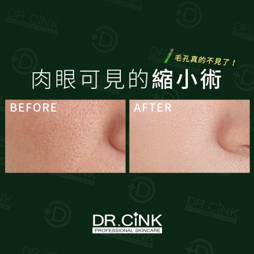 Photo post from drcink.