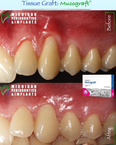 Carousel post from miperioimplant.