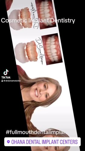Video post from drsionamotufau.