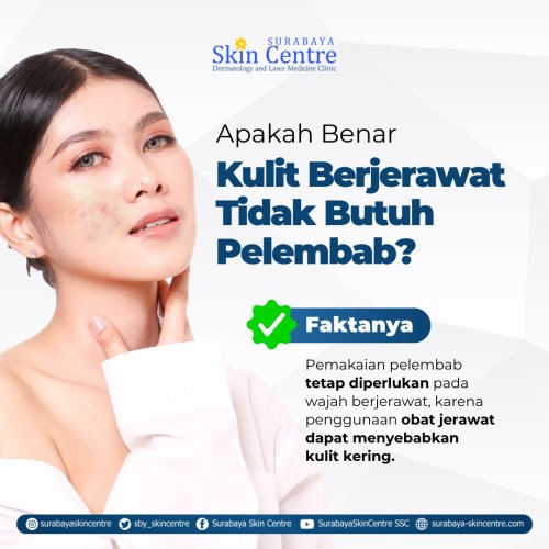 PostPhoto