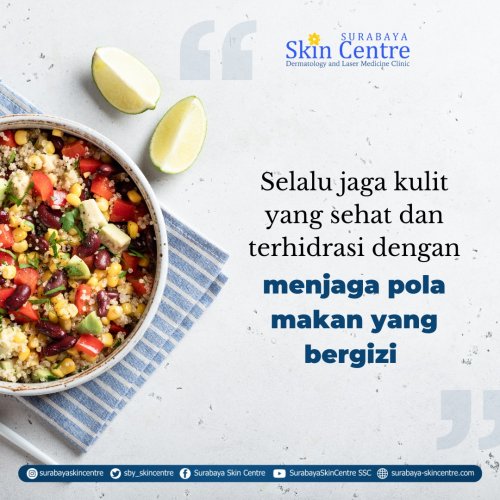 PostPhoto