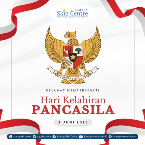 PostPhoto